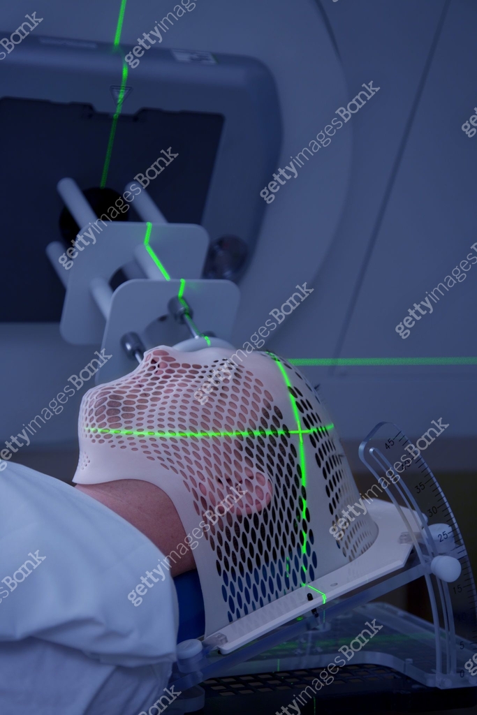 Promethium Radiotherapy Man Receiving Radiotherapy Treatments for Cancer 이미지 (108329639) - 게티이미지뱅크
