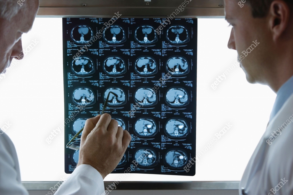 Two doctors review CAT scans on light box 이미지 (520297603) - 게티이미지뱅크