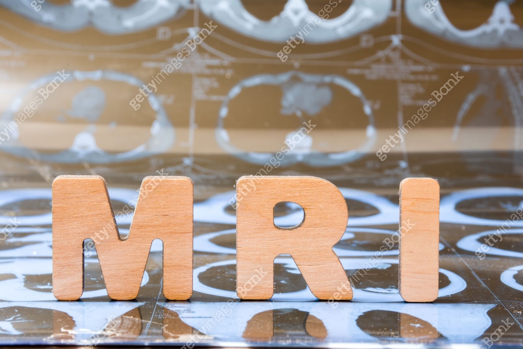 Clinical MRI (magnetic resonance imaging) like radiology technique in ...