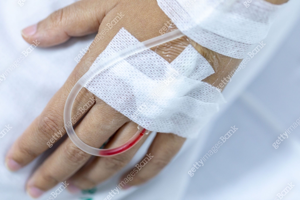 Both Hand Injection Close up hand woman patient with injection Saline in hand and during ...