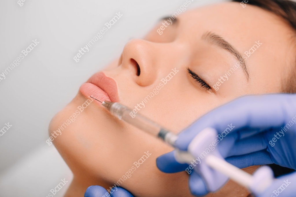 woman having lip injections, procedure lip augmentation 이미지 (1076091088 ...