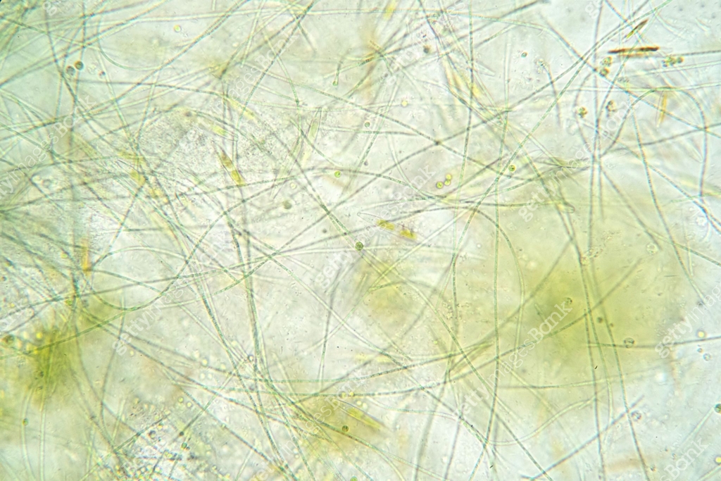 Thread Alage Filamentous algae are single algae cells that form long visible chains ...