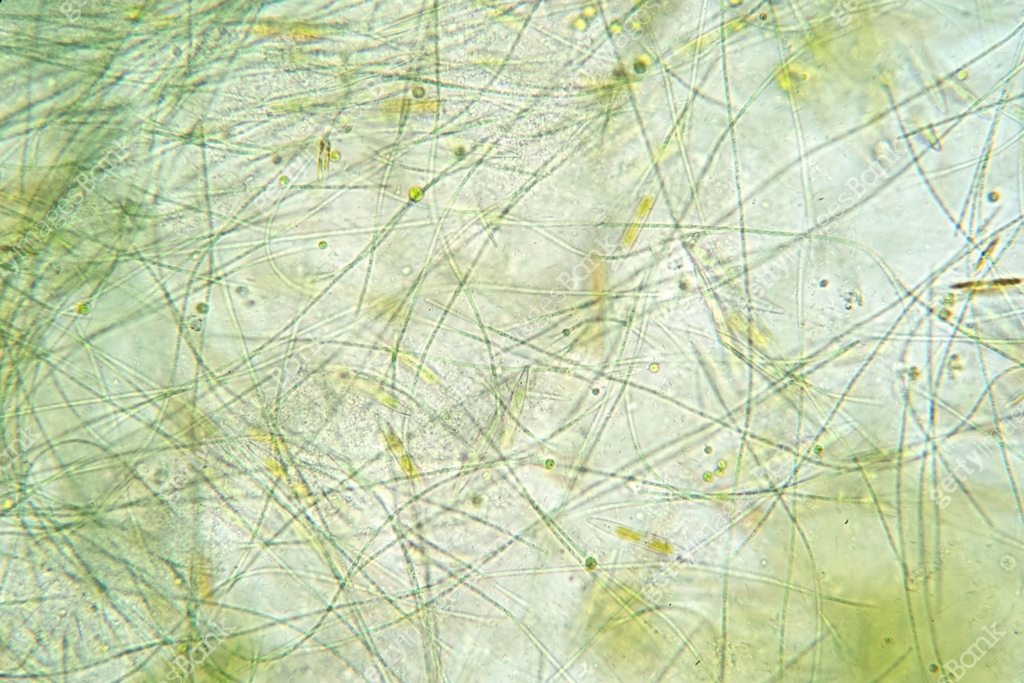 Filamentous algae are single algae cells that form long visible chains ...