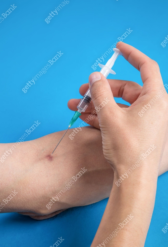 Injection of a drug in a vein with syringe 이미지 (1135359604) - 게티이미지뱅크