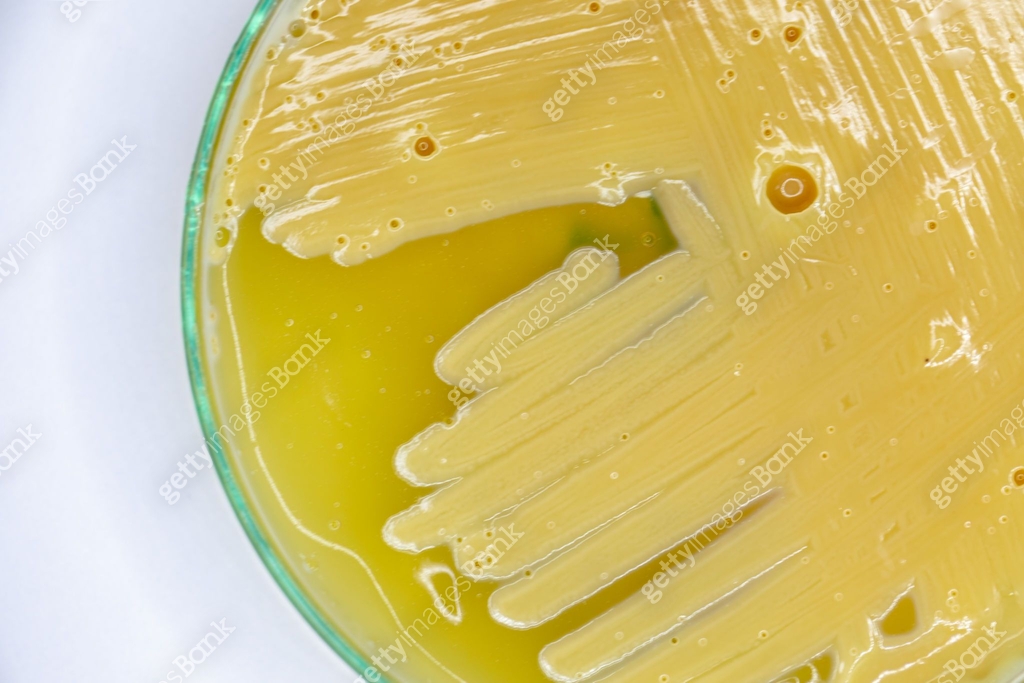 Actinomyces Radingae Study Colony characteristic of Actinomyces, Bacteria, yeast and Mold on ...