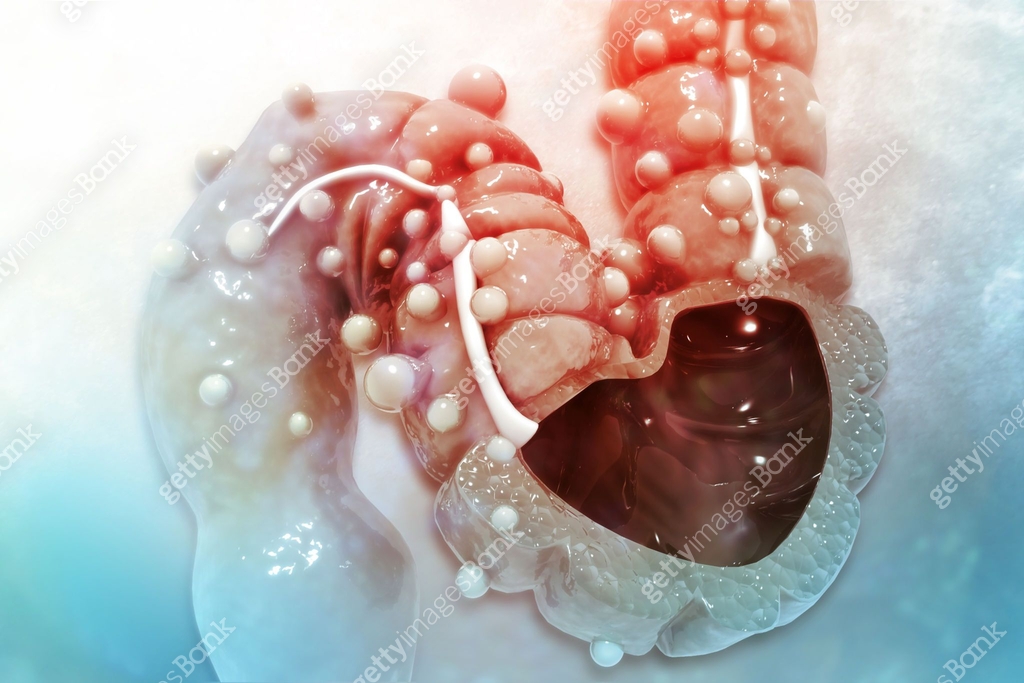 Human colon, Colon anatomy, cross section, colon disease, scientific ...