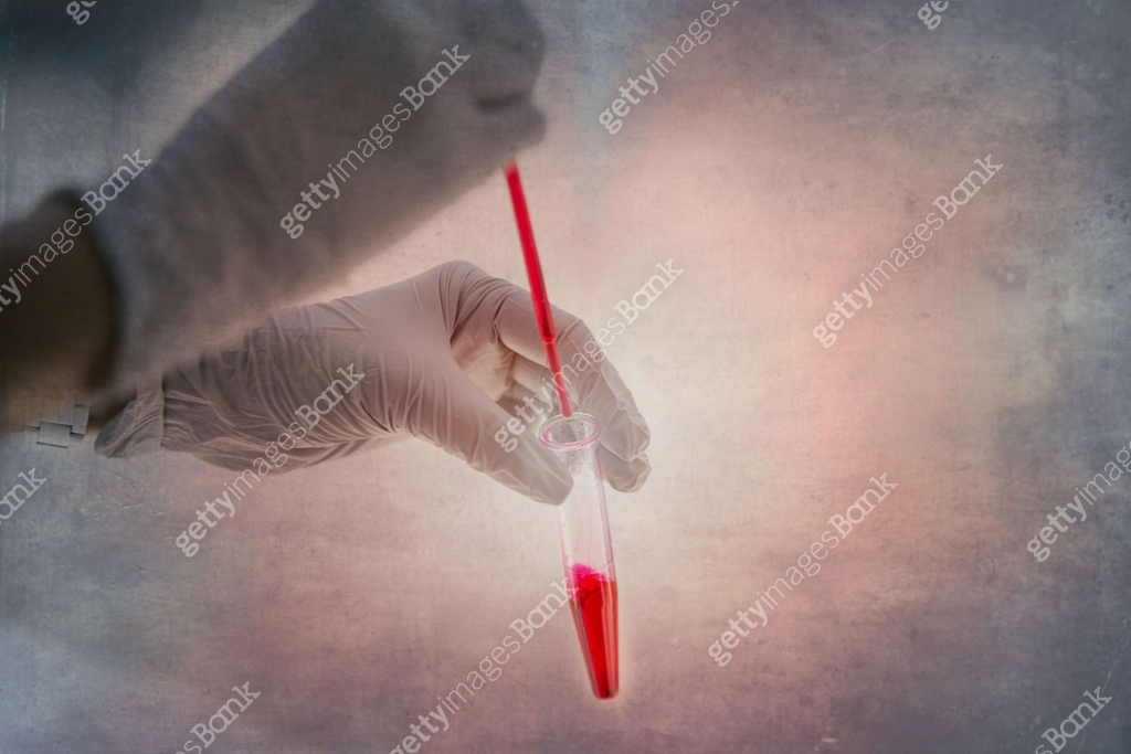COVID 19 lab test 이미지 (1213638975) - 게티이미지뱅크