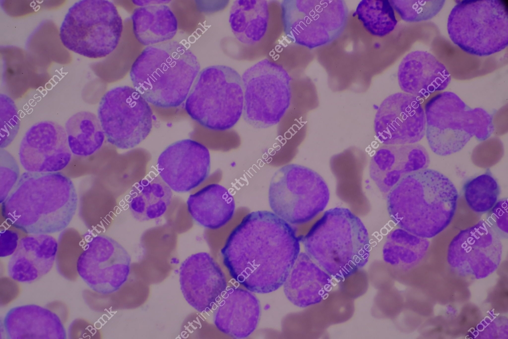 Immature and mature white blood cells.Segmented neutrophil,blast cells ...