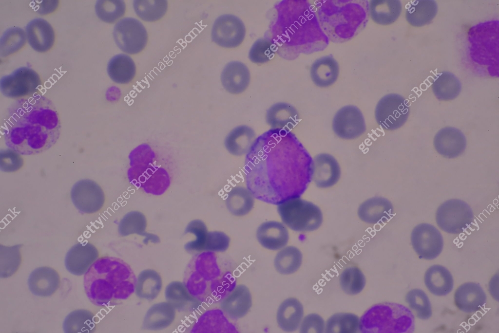 Immature and mature white blood cells.Segmented neutrophil,blast cells ...