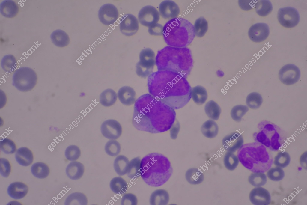 Immature and mature white blood cells.Segmented neutrophil,blast cells ...