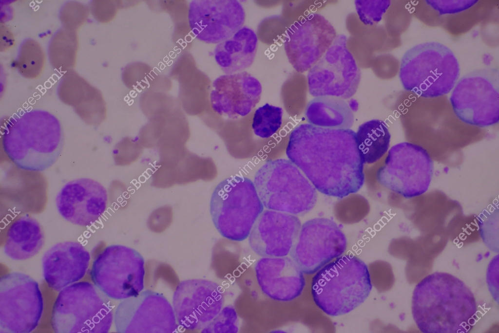 Immature and mature white blood cells.Segmented neutrophil,blast cells ...