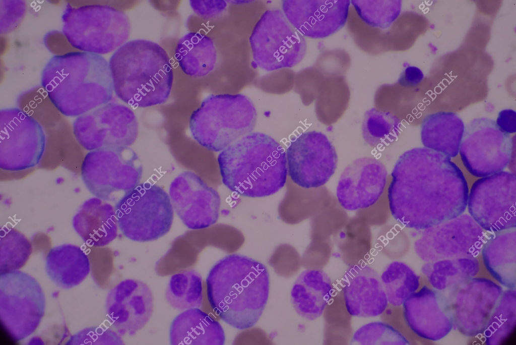 Immature and mature white blood cells.Segmented neutrophil,blast cells ...