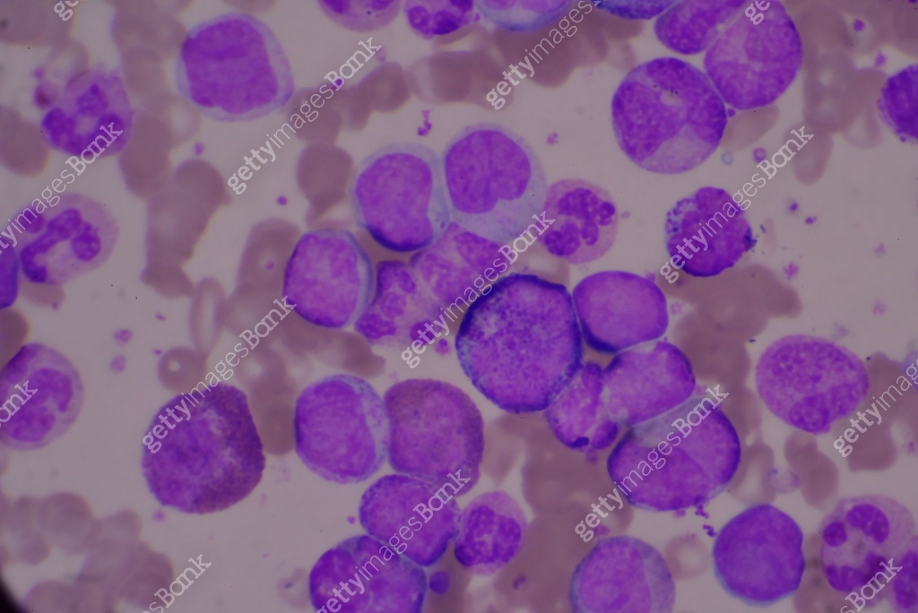 Immature and mature white blood cells.Segmented neutrophil,blast cells ...