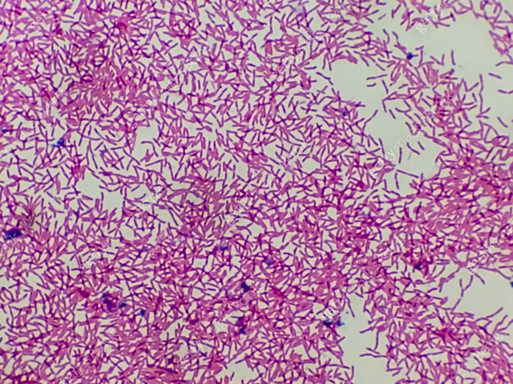 Escherichia coli, also known as E. coli, is a Gram-negative ...