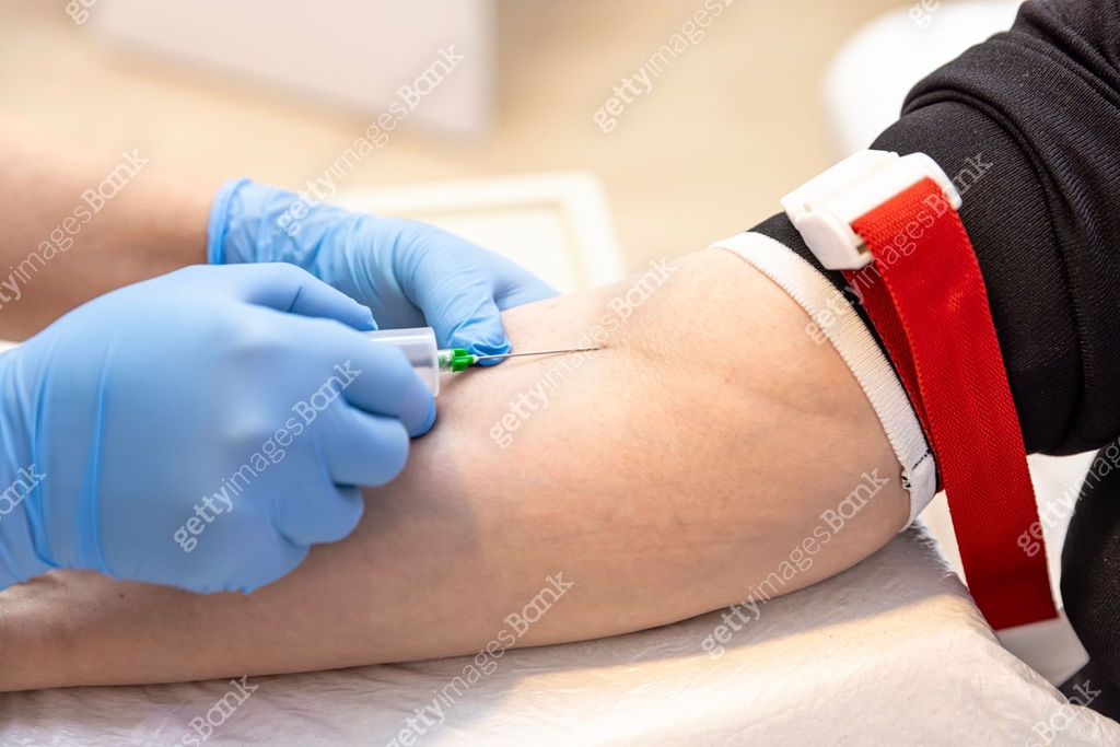 Doctor or nurse taking a blood sample from arm vein with a vacutainer ...