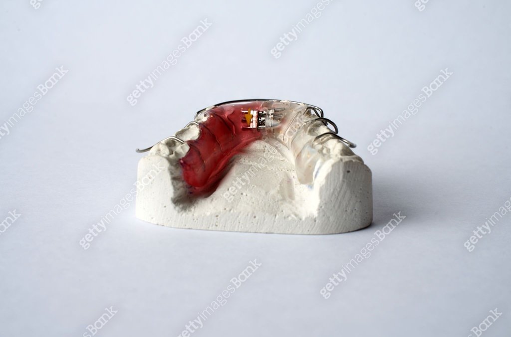 Dental Plate for Children, Retainer for teeth correction. Dental ...