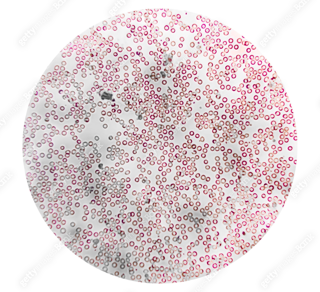 Rolex Rbc Microscope Human blood under a microscope. You can see erythrocytes - red blood ...