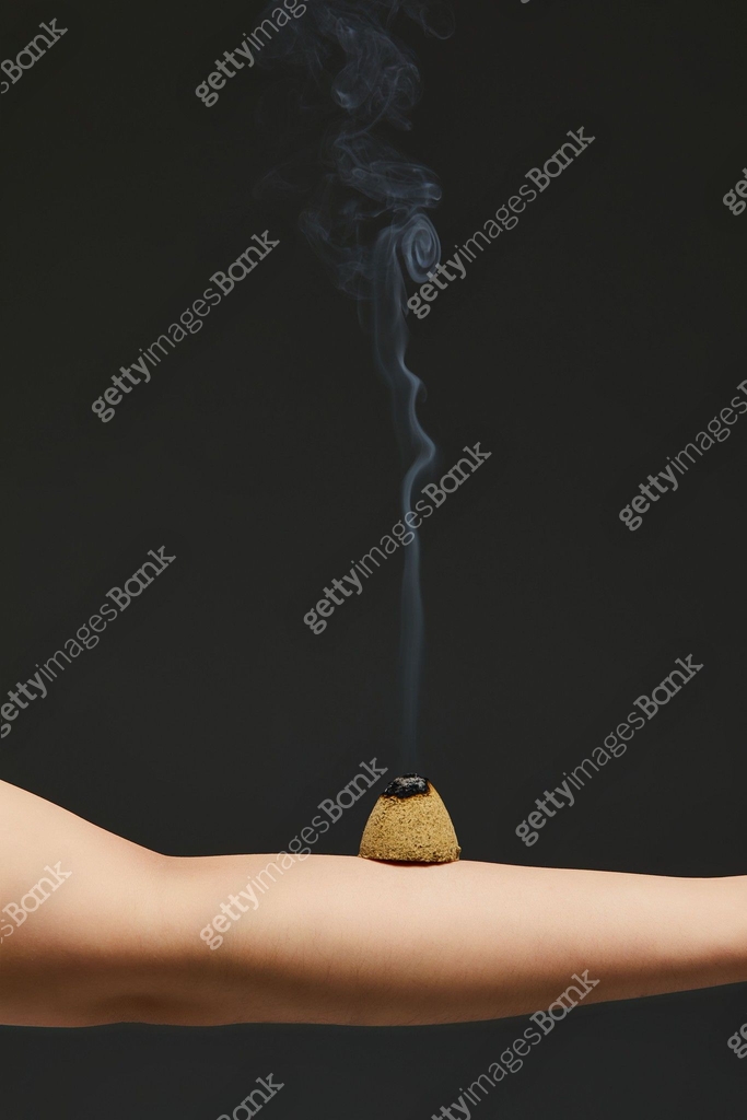 쑥, 뜸, 한의학 (의학), 한의원, 질병, 치료, 대체요법, 의료성형뷰티 (주제) 이미지 (jv11985956) - 게티이미지뱅크