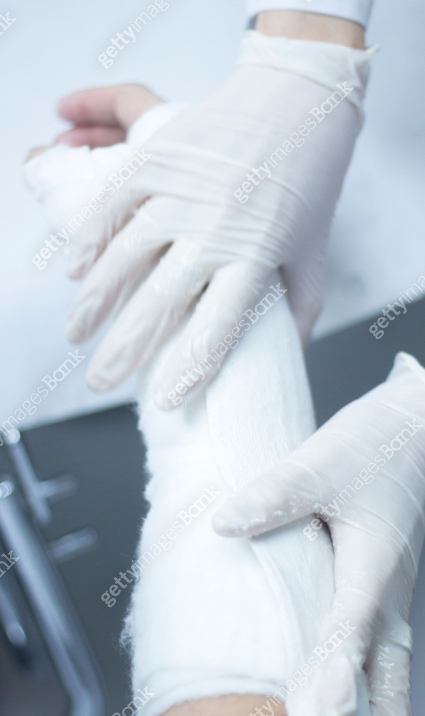Doctor applying a plaster cast and bandages to patient forearm and ...
