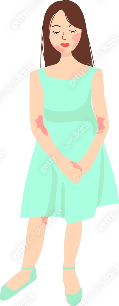 a young girl in dress has skin problems. Dermatitis, atopic dermatitis ...