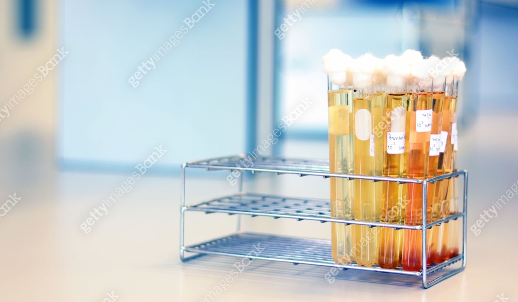 Tryptose Microbiology analysis E.Coli in food sample use Most Probable number ...