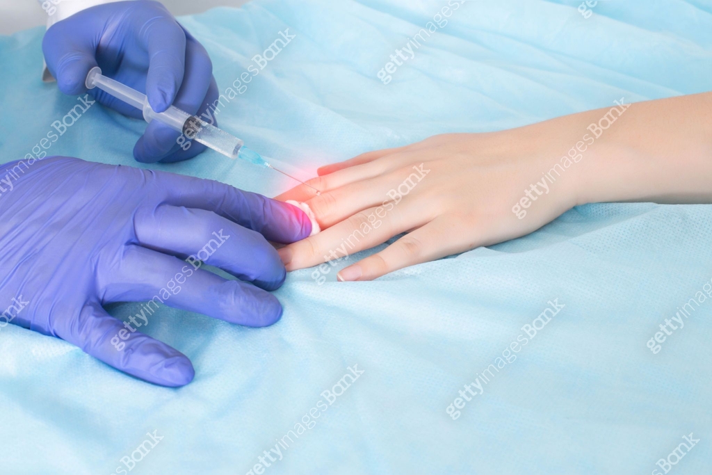 The doctor makes an injection in the joint of the finger on the hand ...