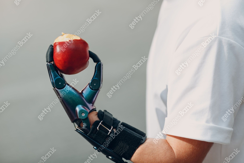 Hand Disable Problem Young disabled man with artificial prosthetic hand in casual clothes ...