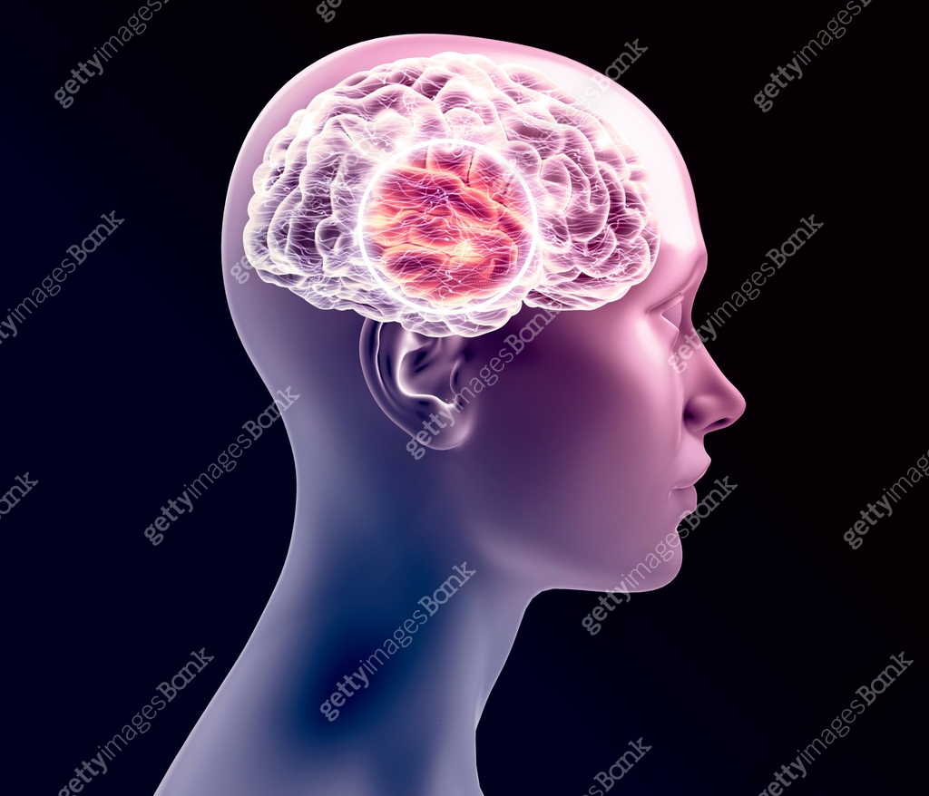 Human brain and man face, side view. X-rays. Degenerative disease ...