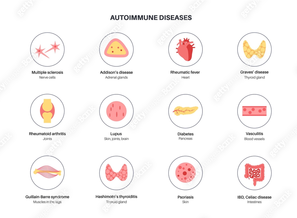 Autoimmune disorders diseases 이미지 (1394711364) 일러스트, 무료 일러스트, 아이콘, 무료 ...