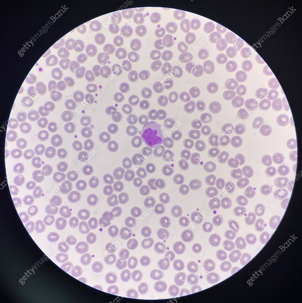 Api Monocyte Monocyte white blood cells on center. 이미지 (1418172831) - 게티이미지뱅크