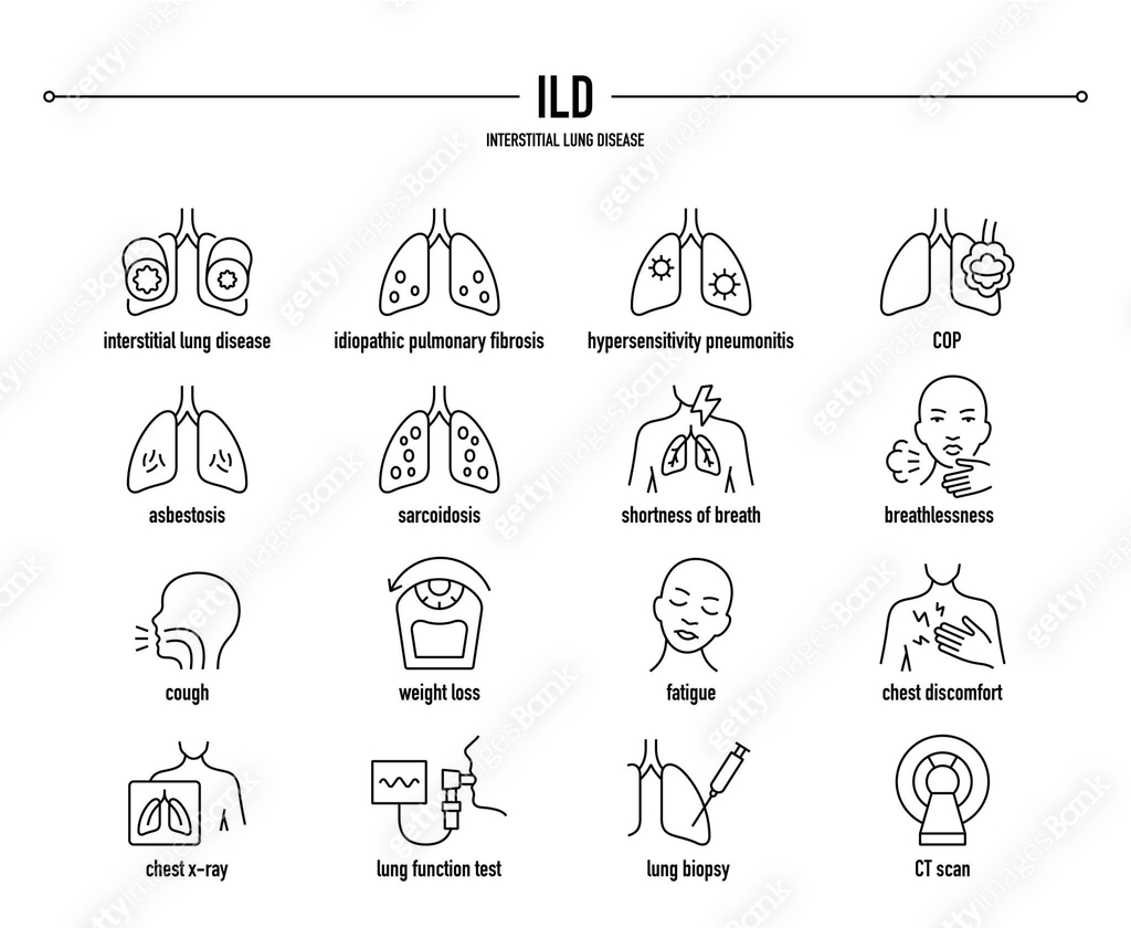 ILD, Interstitial Lung Disease vector icon set 이미지 (1435259571) 일러스트 ...