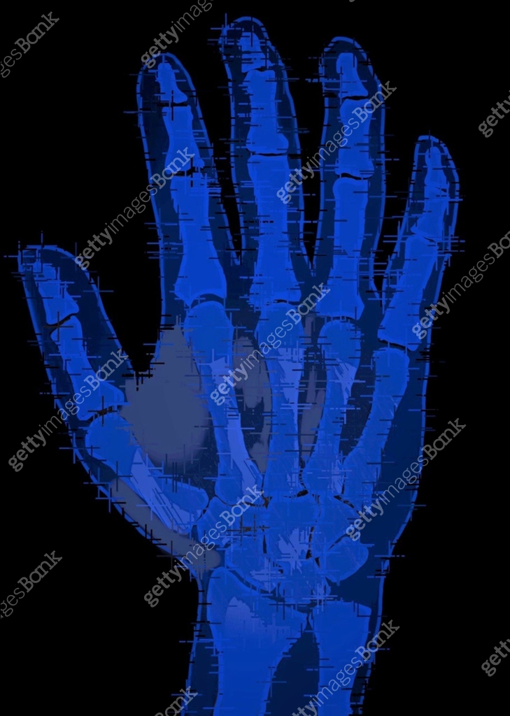 Normal Hand Pic x ray image of normal hand 이미지 (1432888546) - 게티이미지뱅크