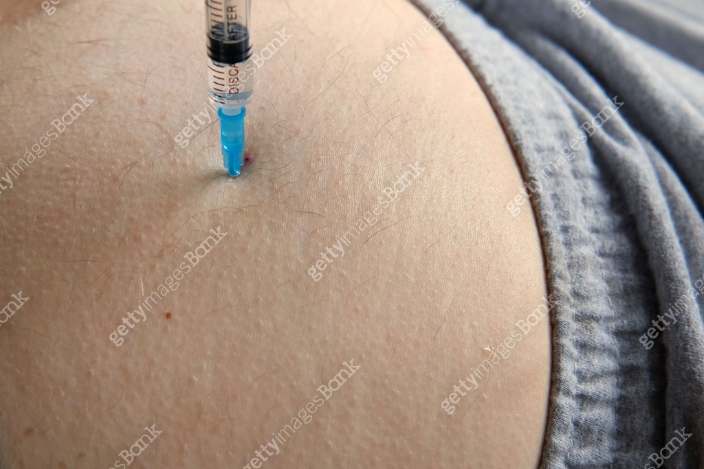 Needle injecting into the muscle. Nurse doing a trigger point injection ...