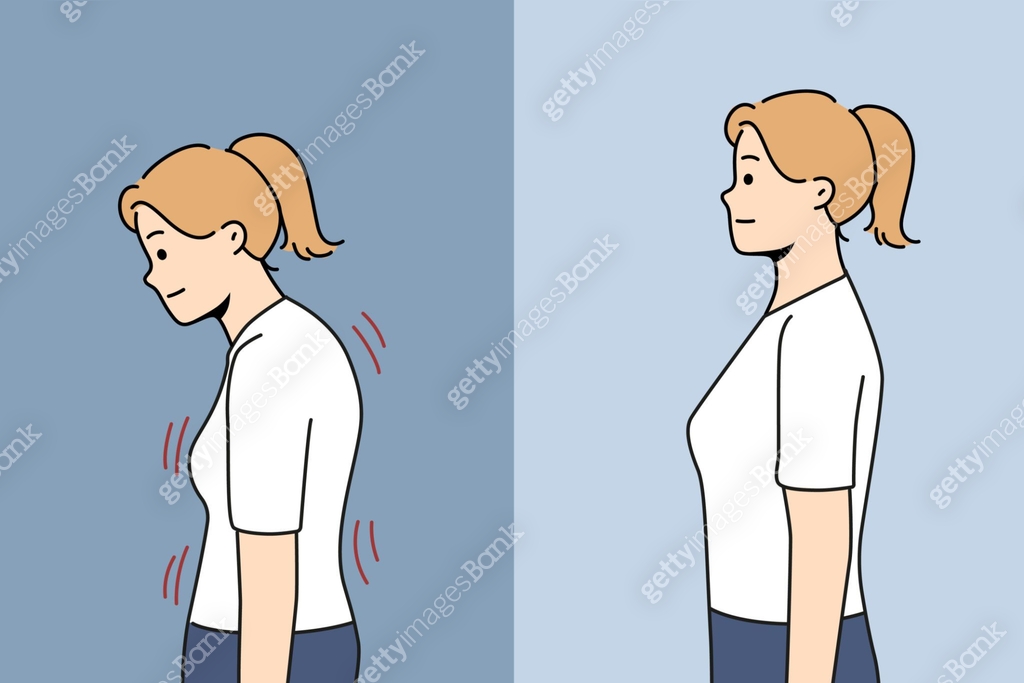 Posture Thanks Stooped woman before and after correcting posture thanks to massage ...