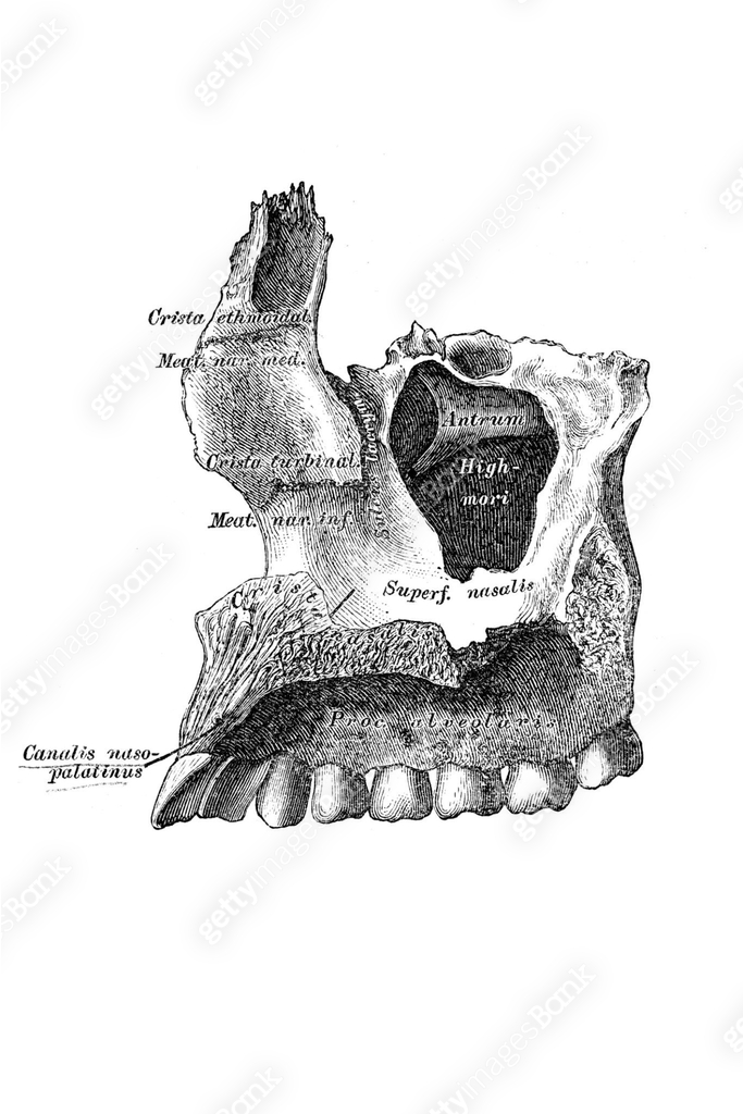 Maxilla Bone Exploded View Right maxillary bone, superior maxilla, from the inside 이미지 (1604745826 ...