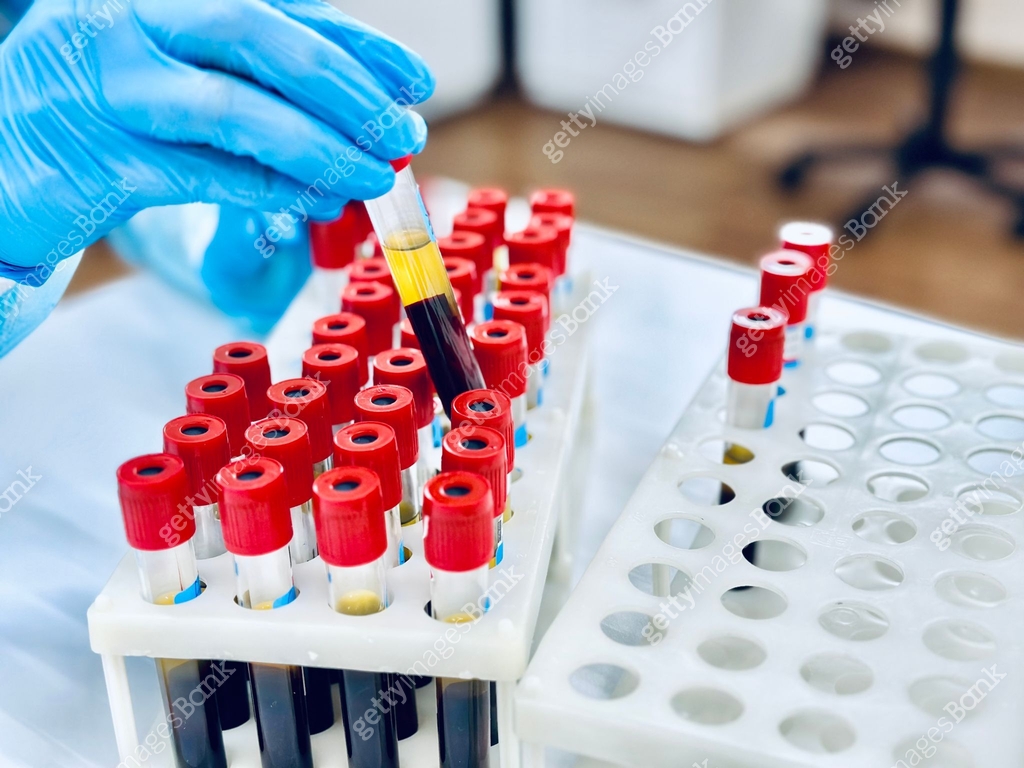 Preparing A Testing Lab Laboratory technician preparing blood sample for medical testing in ...