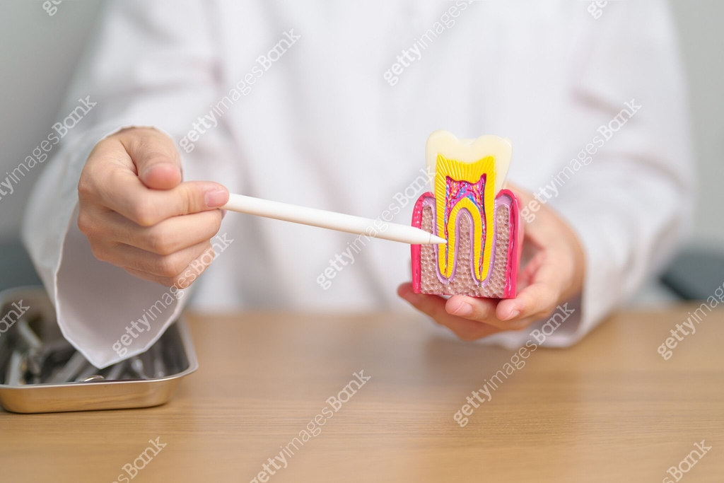 Toothache Model Dentist with tooth Anatomy model. Oral Teeth decay and disease, Scrape ...