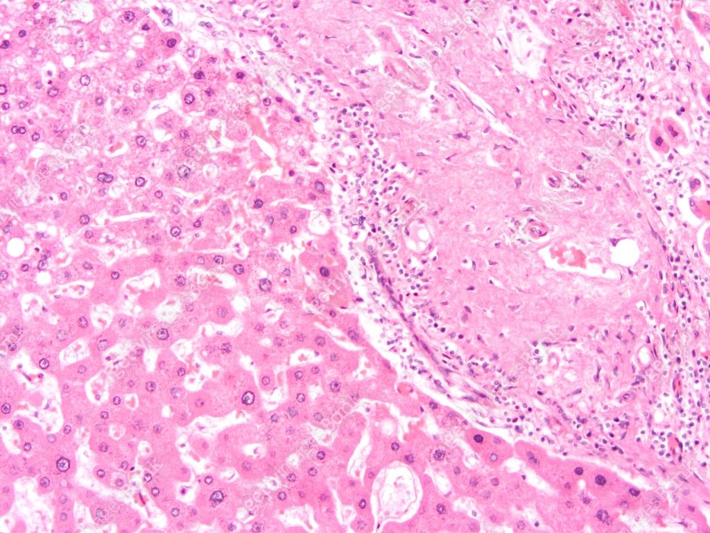 Lens Tissue Microscope Photographs of human tissue through a microscope lens. 이미지 (2149333123 ...