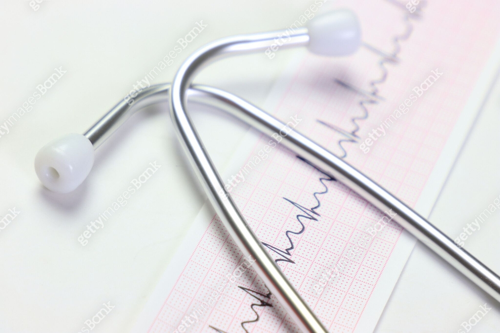 EKG paper with trace and a stethoscope in front of it. Close up view of ...