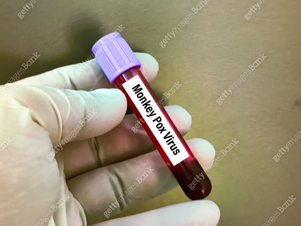 Monkeypox Lab Specimen Types Biological specimens for Monkeypox virus test. It is also known as the ...