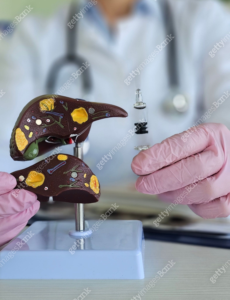 Liver anatomy model with injection syringe 이미지 (2180819864) - 게티이미지뱅크
