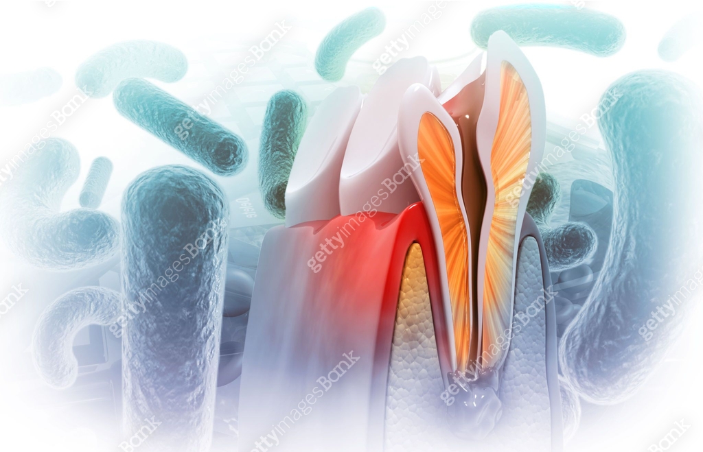 Hujan Tooth Pattern Human tooth cross section anatomy, tooth infection 이미지 (2179166901 ...